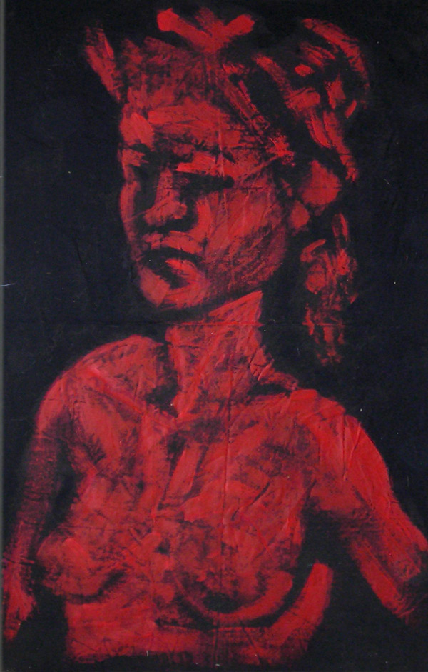Amblyope n°2